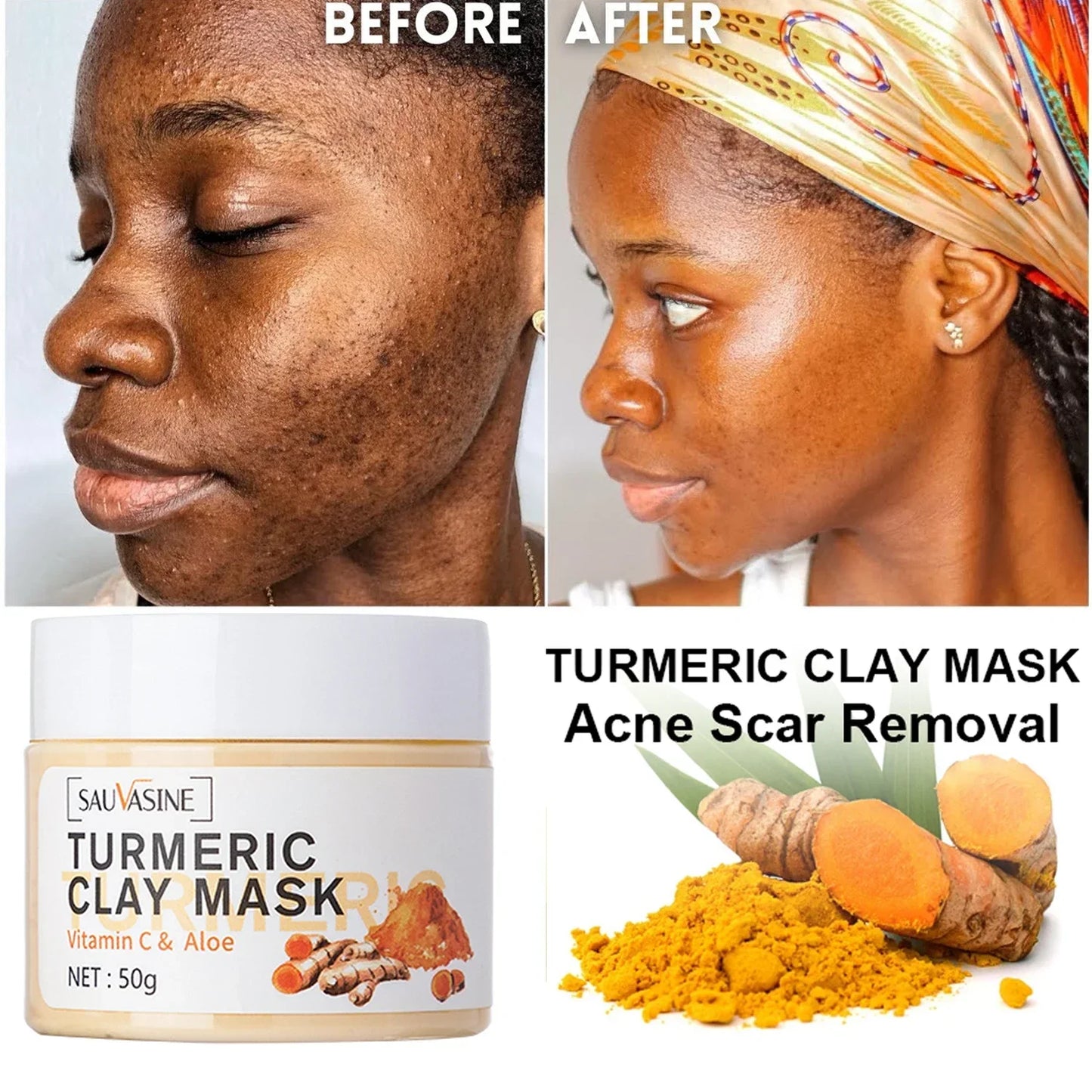 Turmeric Vitamin C Face Mask